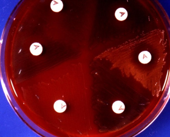 File:Bacitracin Streptococcus-pyogenes.png