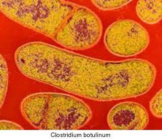 File:Botulism bacteria.jpg