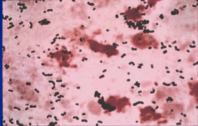 File:Gram-stain of GBS.png