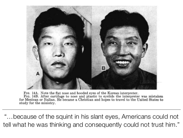File:The-curious-beginnings-of-double-eyelid-surgery-in-1950s-korea-18-638.jpg