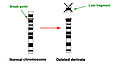 Diagram of a terminal chromosome deletion