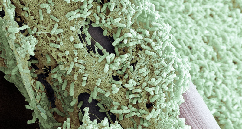 File:Biofilm layer formed by Pseudomonas aeruginosa (green).png