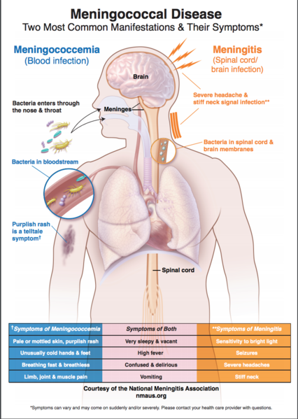 File:Meningococcal Disease Systems and Symptoms.png