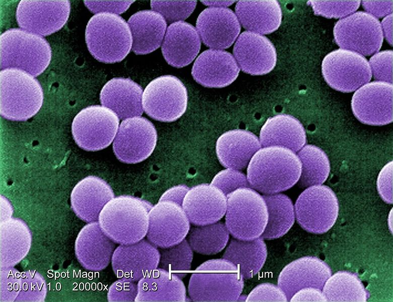 File:Staphylococcus aureus.jpg