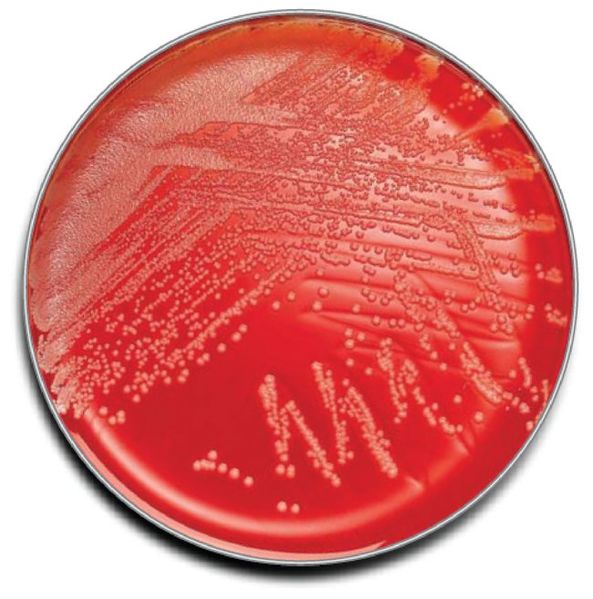 File:Columbia blood agar.jpg