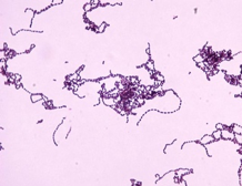 File:GramStain Streptococcus-pyogenes.png