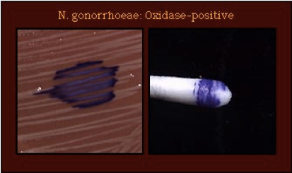 File:Fig. 5. N. gonorrhoeae positive oxidase test.png