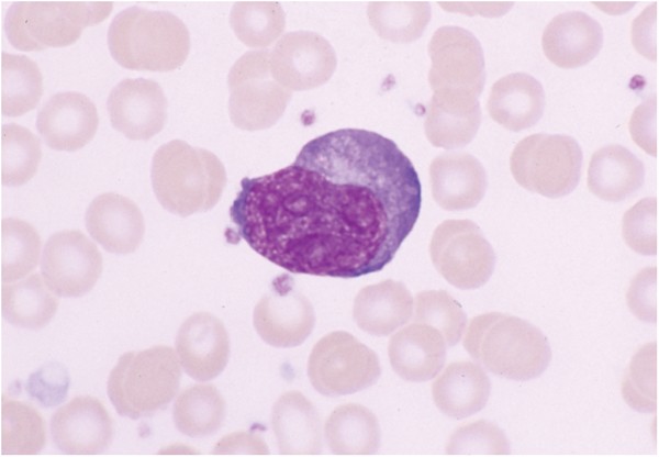 File:Case 3 Ehrlichia Blood Smear.jpg