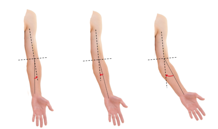 File:Figure 4. Difference between varus and valgus motion.png