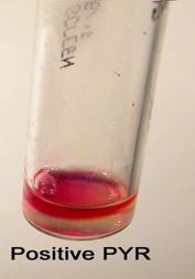 File:PYR Streptococcus-pyogenes.png