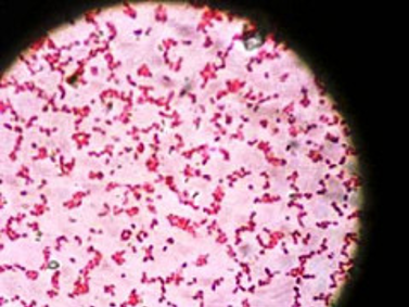 File:Campylobacter jejuni.png