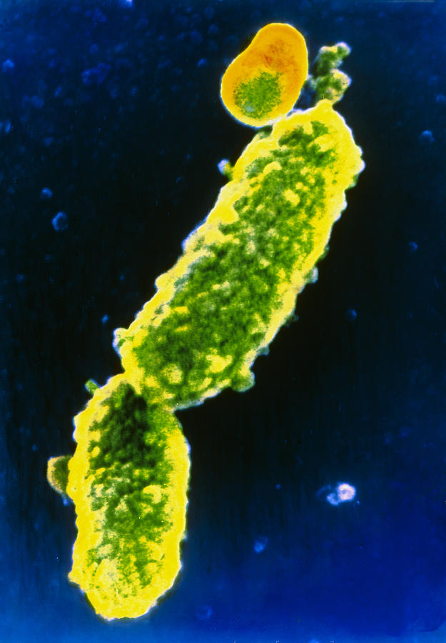 Бордетелла. Бактерия Bordetella pertussis. Коклюшной палочкой борде-Жангу. Коклюш палочка борде Жангу. Коклюш бордетелла пертуссис.