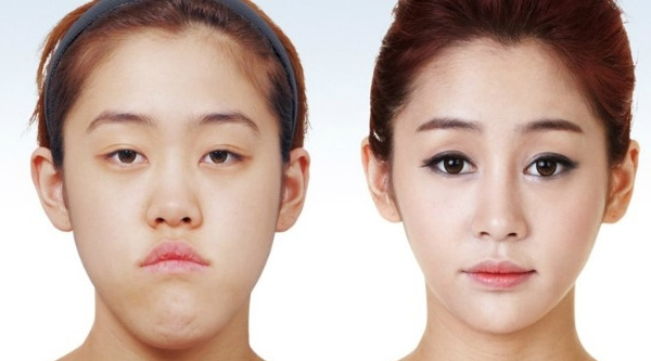File:Korean-plastic-surgery.jpg