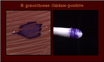 File:Oxidase test.jpg