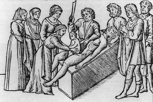 File:A live infant being surgically removed from a dead woman. Earliest illustration of Cesarean section.jpg