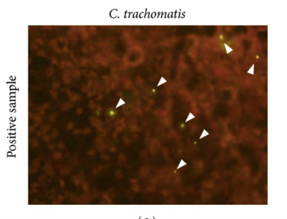 File:Figure 8. C trachomatis.png