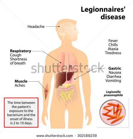 File:Legionnaires disease signs and symptoms.jpg