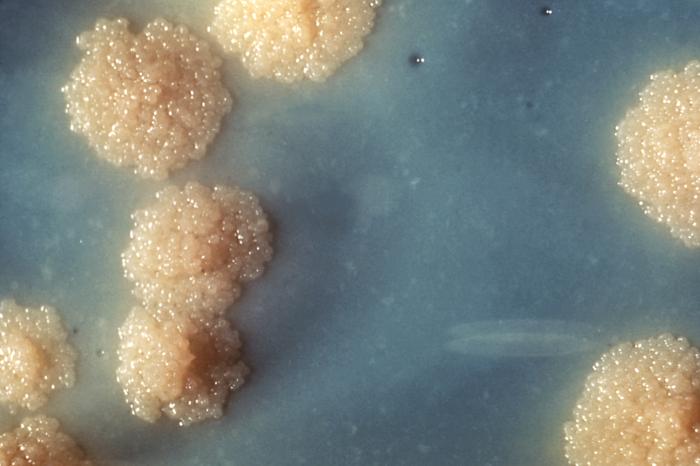 File:Mycobacterium tuberculosis Culture.jpg