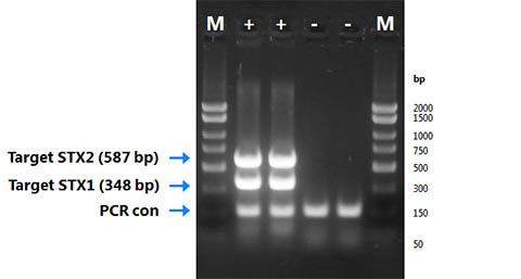 File:Figure 13. Agarose gel electrophoresis of PCR products generated from an E. coli O157 detection kit. Reprinted from (17).jpg