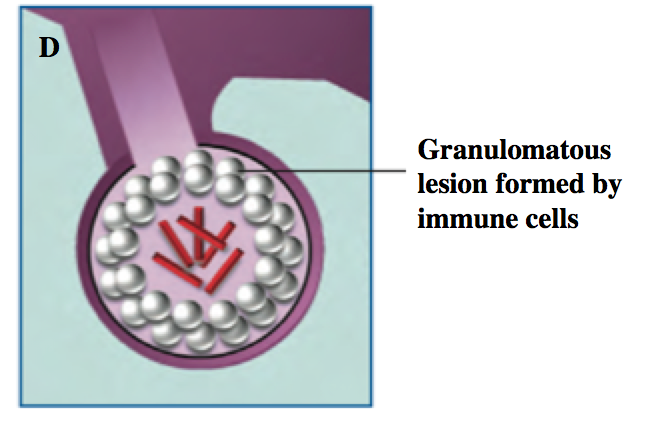 File:Granuloma formation.png