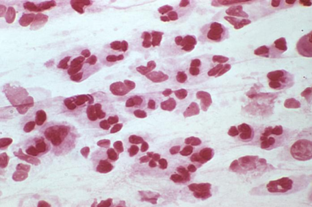 File:Figure 2. Gram Stain.png