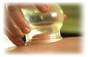 File:Cupping.gif