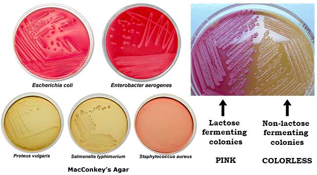 File:Figure 7. Growth of various microorganisms on MacConkey agar. Reprinted from (4).jpg