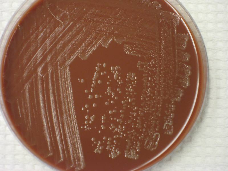 File:Haemophilus influenzae on Chocolate-Agar Plate.jpg