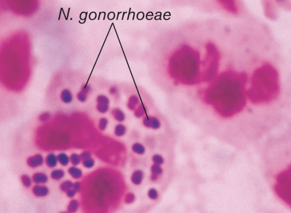File:N. gonorrhoeae.png