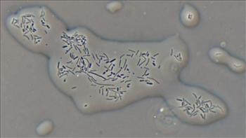 File:Oilbacteria.jpg