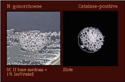 File:Fig. 6. N. gonorrhoeae positive catalase test.png