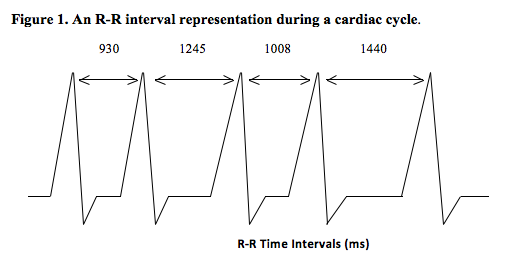 File:An R-R Interval Representation of a Cardiac Cycle.png