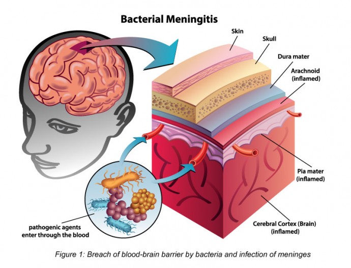 File:Breach of blood-brain barrier by N. meningitidis and infection of meninges.jpg