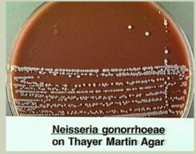 File:N. gonorrhoeae on Thayer Martin Agar.png
