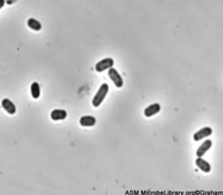 File:E. coli O157 H7.png