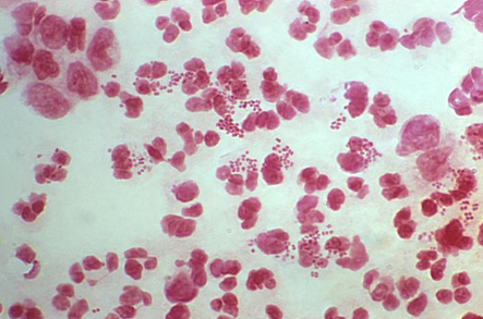 File:Gram stain.png
