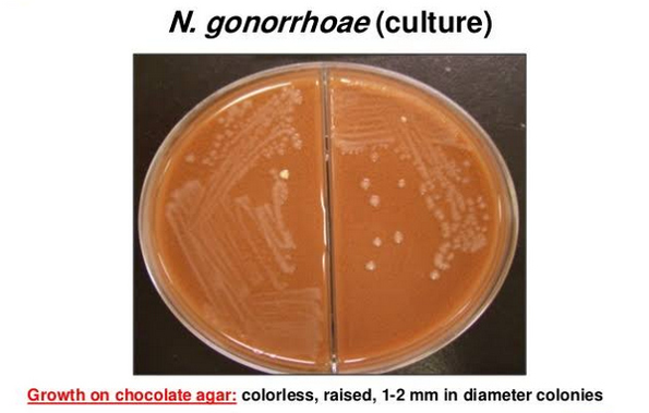 File:Figure 3. N gonorrhoeae.png