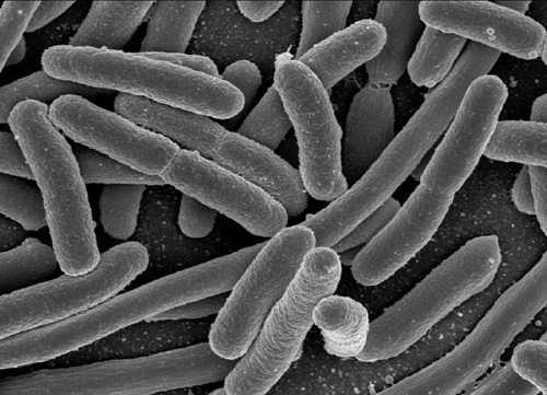 File:E. Coli 0157 H7 bacteria imaged through Electron Microscopy.jpg
