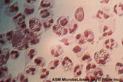 File:Fig. 3. Gram stain of N. gonorrhoeae.png