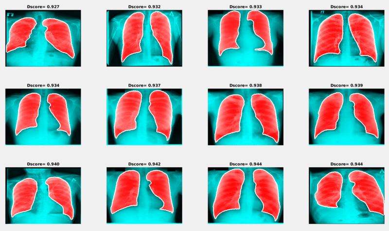 File:Lungs.png
