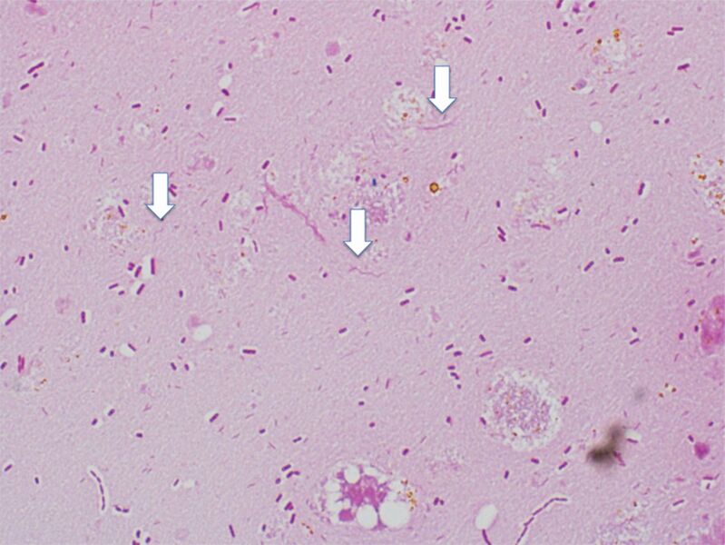 File:Figure 9. Gram-negative Campylobacter organisms in a mixed culture (indicated with arrows). Reprinted from (10).jpg