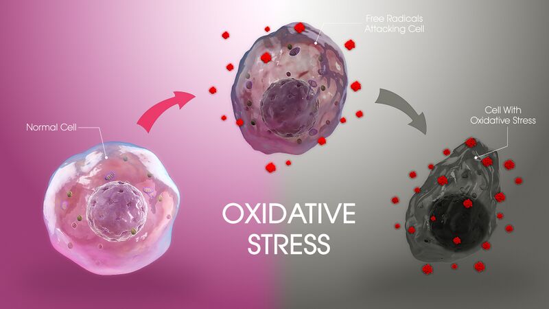 File:Figure . Cell response to oxidative stress.jpg