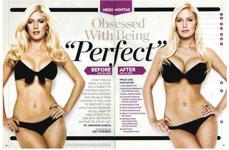 File:Heidi Montag's Obsession with Plastic Surgery.jpg