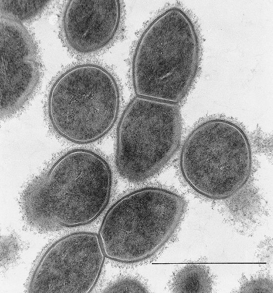 File:Streptococcus pneumoniae1.jpg