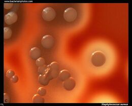 Beta Hemolysis Staphlococcus Aureus.jpg