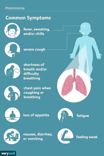 File:Fig 3. Symptoms of Pneumonia, similar to Robert’s symptoms.jpg