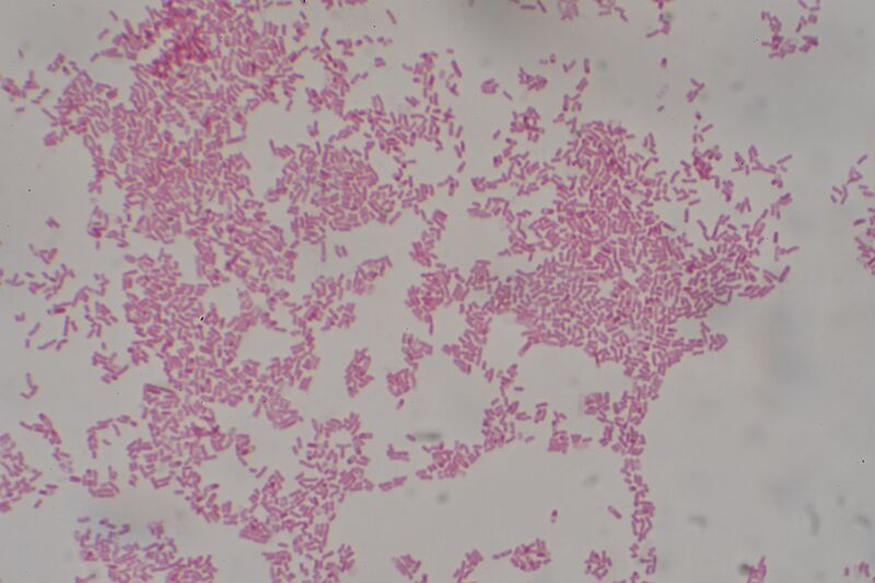 File:Figure 8. Gram stain of Escherichia coli. Reprinted from (9).jpg