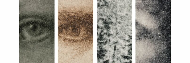 Examples of the reticulation pattern seen under magnification from the ​Graphic Atlas