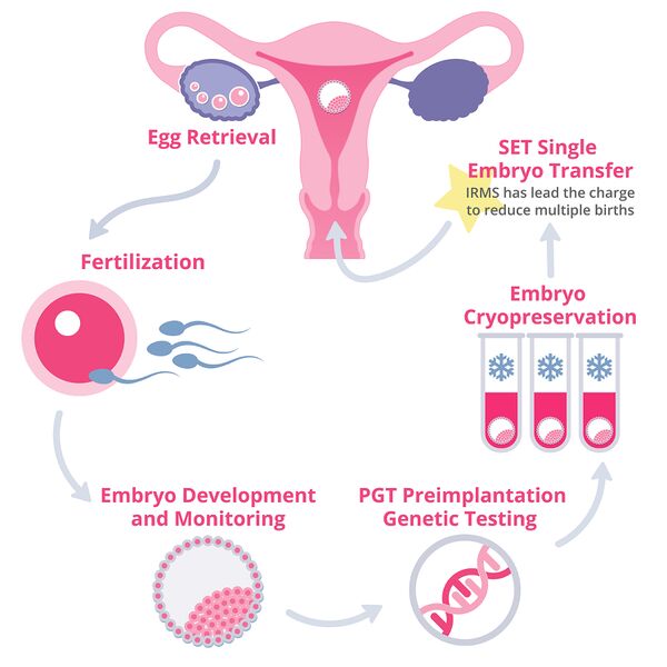 File:In vitro fertilization process.jpg