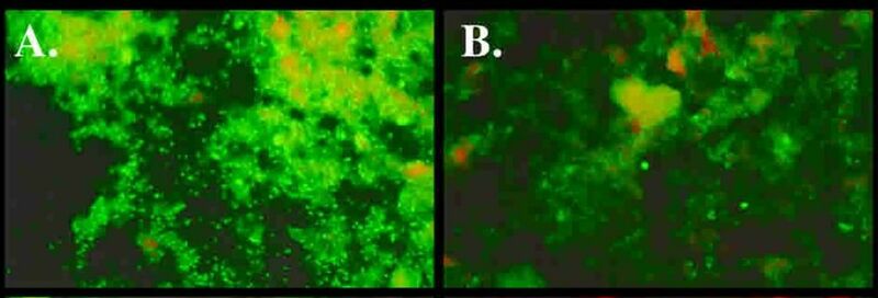 File:Representative indirect immunofluorescence assay staining of susceptible cells against either spotted fever group rickettsiae (A and B).jpg